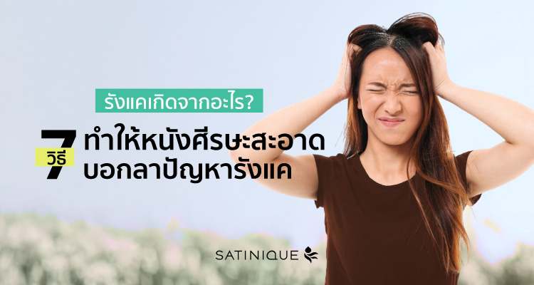 รังแคเกิดจากอะไร? 7 วิธีทำให้หนังศีรษะสะอาด บอกลาปัญหารังแค